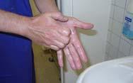 hand disinfection) 3 minutes (surgical hand disinfection) 35 Scin