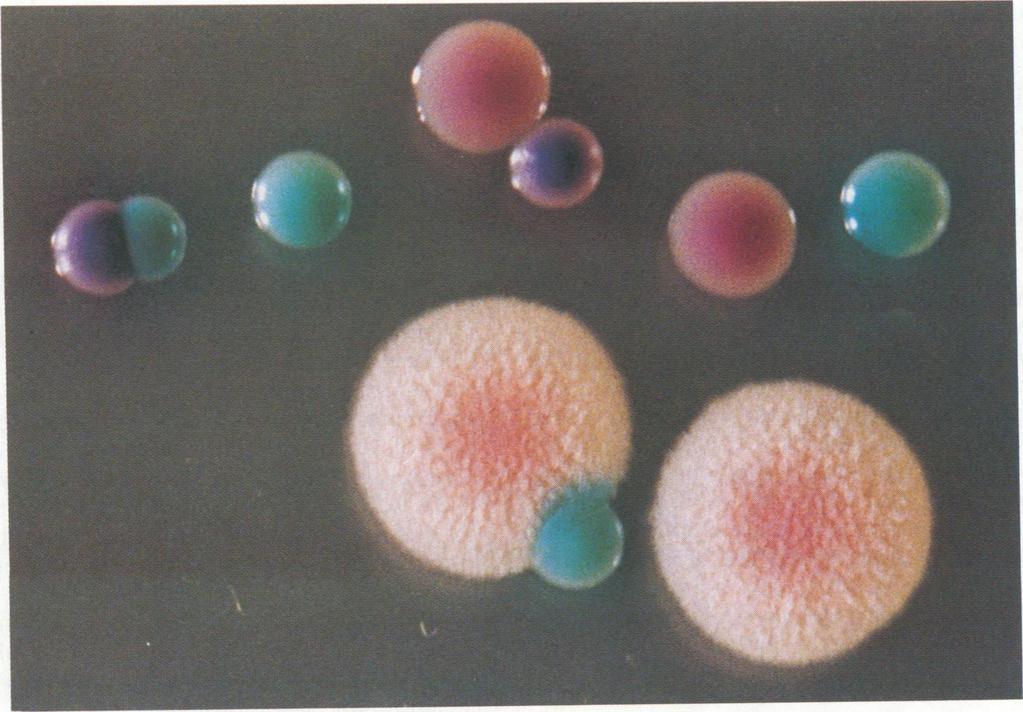 VOL. 32, 1994 NEW DIFFERENTIAL MEDIUM FOR CANDIDA SPP. 1927 FIG. 1. (A) Dark pink colonies (paler edges) of C. glabrata grown for 48 h on CHROMagar Candida at 37 C. (B) Pale colonies of C.