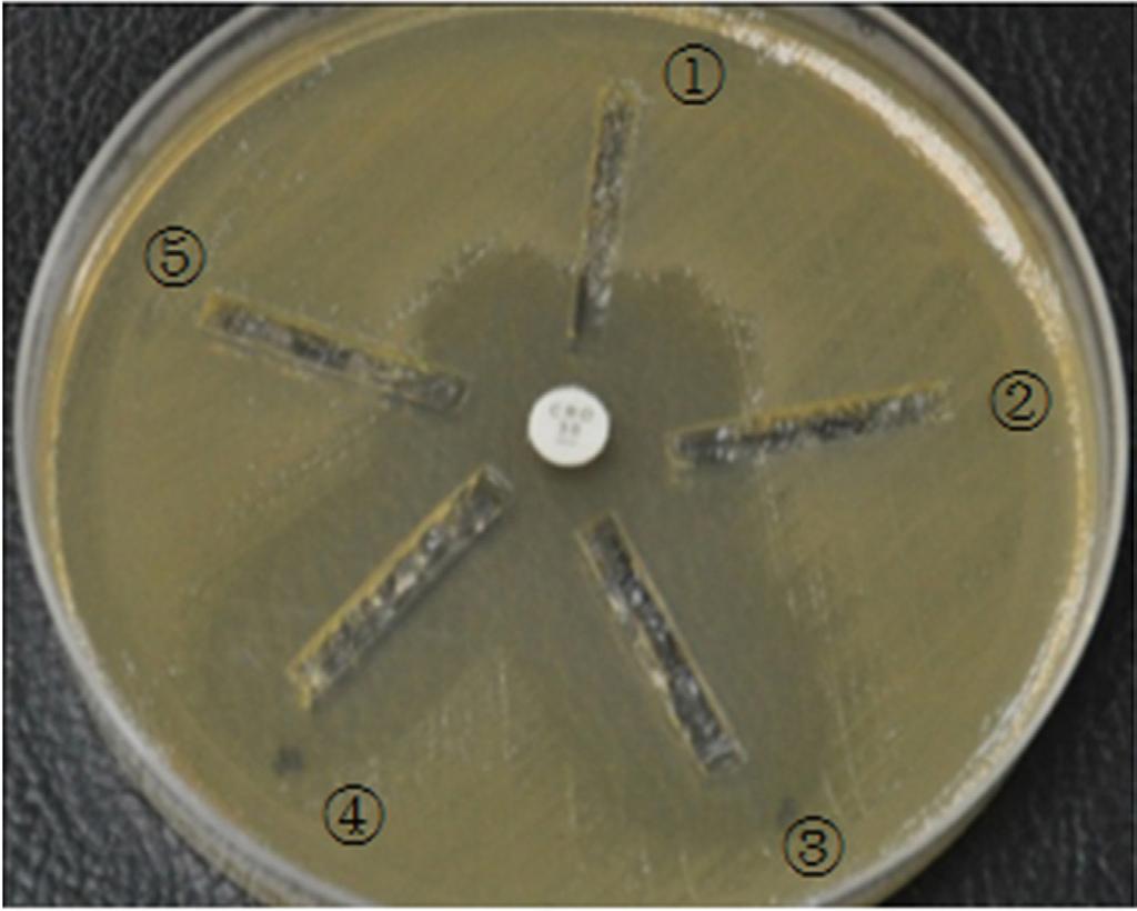 J.L. Shen et al. 14462 Table 1. Result of 8 strains of Acinetobacter baumannii resistant to carbapenems inhibited by efflux pump inhibitor L-PAβN. (MIC unit: μg/ml). Strain No.