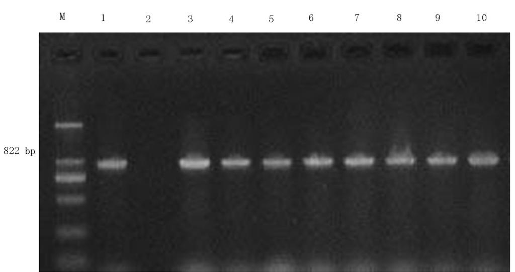 Detection of β-lactamase genes Carbapenamase genes were detected in the eight PDR-AB strains by PCR, using the primers for KPC, including those of the OXA23, OXA24, OXA48, OXA50, OXA55, OXA58, OXA60,