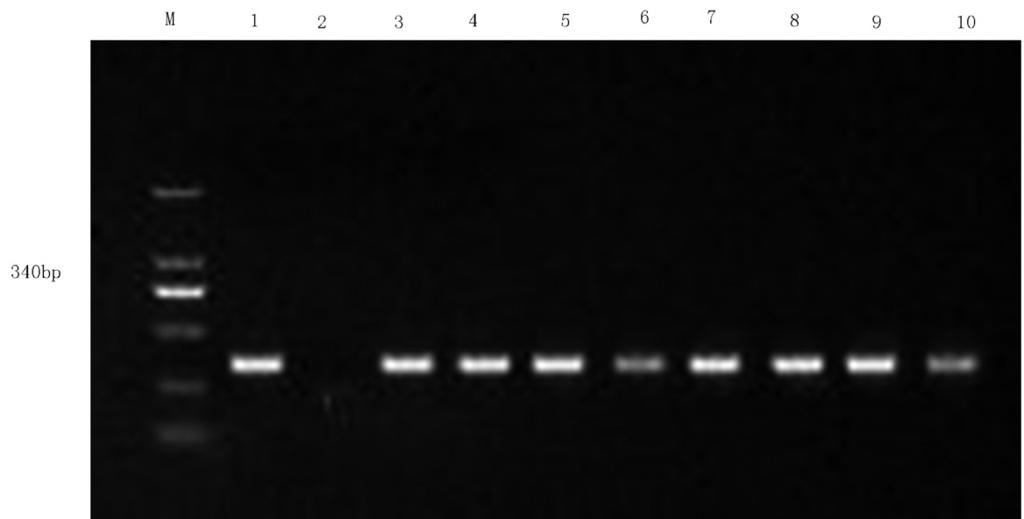 Using the primers of TEM, OXA23, and KPC-2, the full-coding sequences were PCRamplified and sequenced for strains that were positive for these genes.
