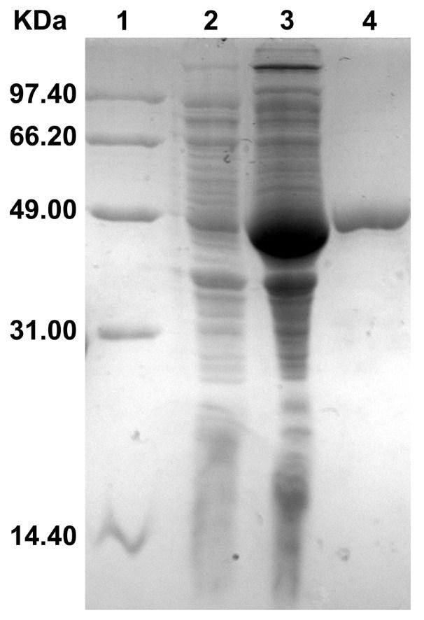 2.1 SDS-PAGE analysis of fusion protein FGG-recoverin-GST Lane 1: Protein Marker. Lane 2: E.