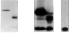 Three Lactococcus lactis strains (MG1363(pNuc1), MG1363(pNuc2) and MG1363(pNuc3)) were plated onto BHI agar culture medium (Brain Heart Infusion, Difco, Grand Island, NY) containing erythromycin (5