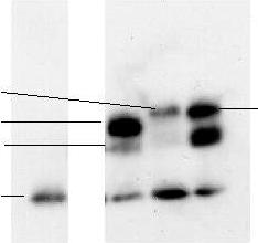 Heterologous protein secretion in Lactococcus lactis 197 std S1 S2 S3 std S1 S2 S3 LEISSTCDA-BCV-B LEISSTCDA-B B LEISSTCDA-VCB-B LEISSTCDA-BCV-B A