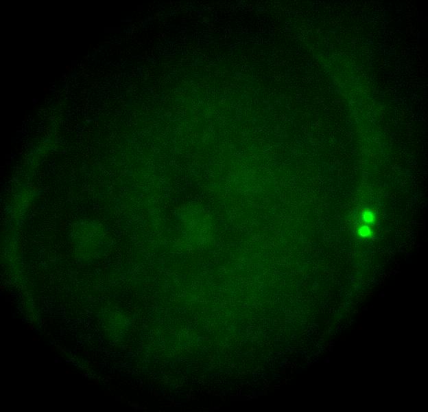 co-stained with (for centrosome) and Centrin-2 (centriole) antibodies.
