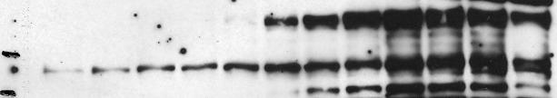 WT wild type or GFP-Orc1 R15Q mutant protein.