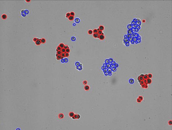 Live cell Dead cell The MCF7, breast cancer cell line can be clumpy.