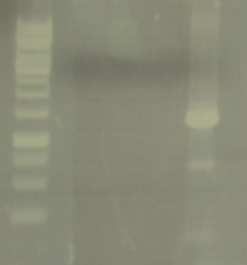2 3 4 5 6 7 Fig. 1. The electrophoregrams obtained by using the extracted DNA (A) and the amplification products after PCR with 63f and 1387r primers (B).