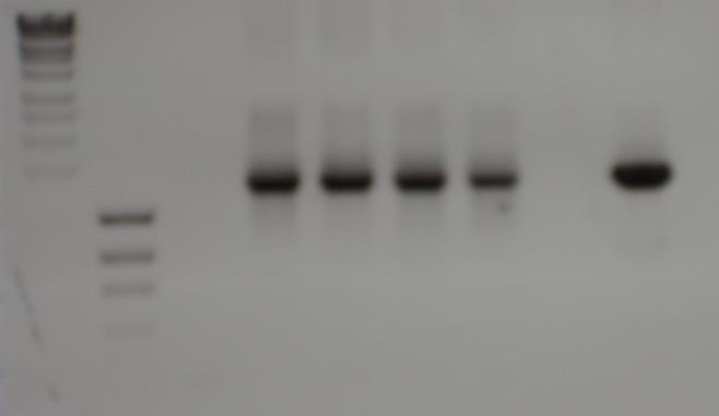 and 6 the anaerobic digester s samples amplicons, 7 bacterial positive control 1 2 