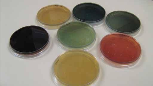Figure 5. This photo shows seven dishes each containing a different sample of Pseudomonas bacteria. The bacteria can have different colours we don t know exactly what that means!