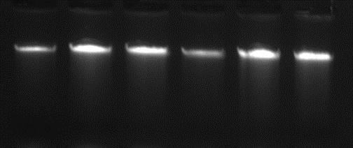 Ten ul each DNA was analyzed on 1 % agarose gel. Total DNA extraction from buccal swab using 5 min Swab/Saliva DNA Extraction Kit.
