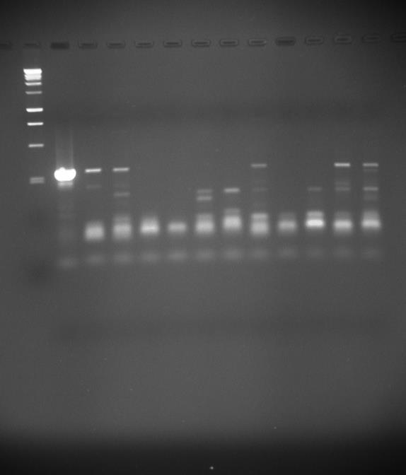 Gel photo using DNA from Elute