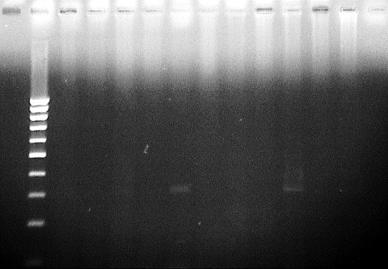 Gel photo using MyTaq Blood-PCR