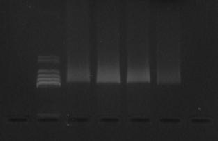 6. Troubleshooting 6.1 Humic Acid Contamination Some stool samples contain very high levels of humic acids which may co-purify with the genomic DNA.
