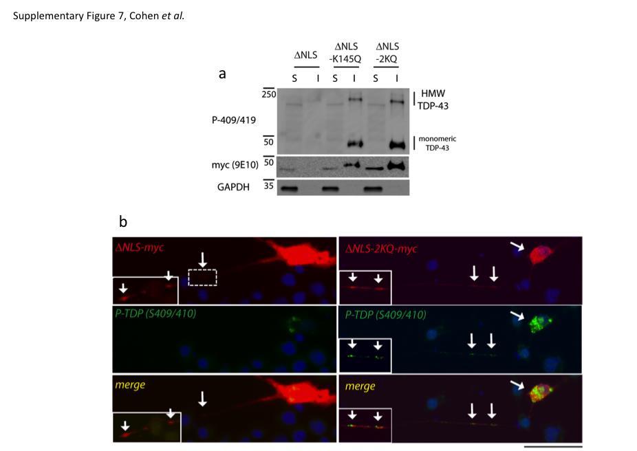 Supplementary Figure 7: TDP-43 acetylation-mimics promote TDP-43 aggregation in differentiated Neuro2A cells a) Neuro2A cells were transfected with cytoplasmic TDP-43 (TDP-43-ΔNLS), or plasmids