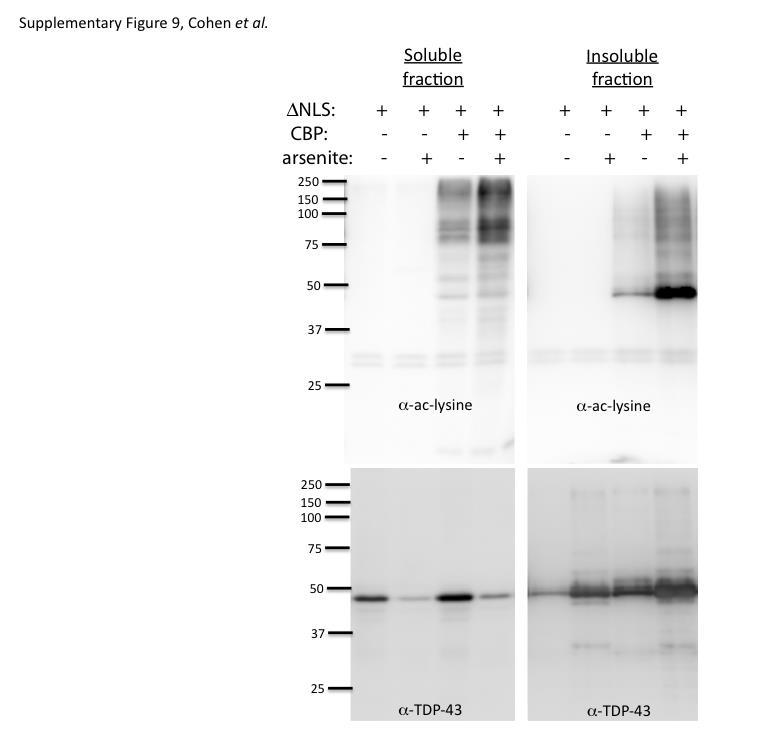 Supplementary Figure 9: Oxidative stress induces TDP-43 acetylation Immunoblotting of cell lysates from soluble and insoluble