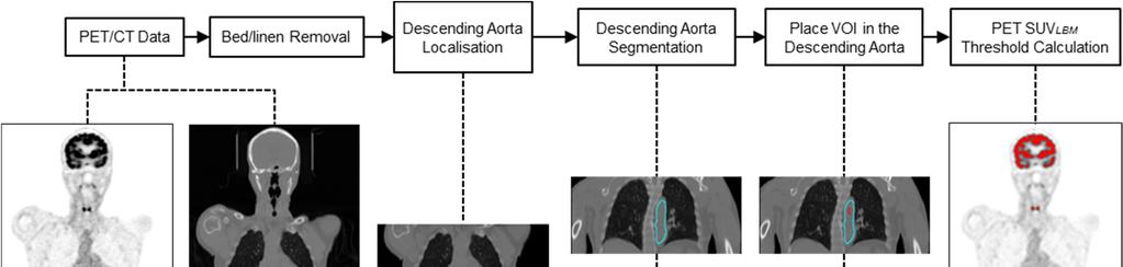 fully automatic approach to the segmentation of the descending aorta with the use of multi-atlas registration coupled with weighted decision function was applied.