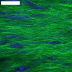 Intermittent strain accelerates tissue development