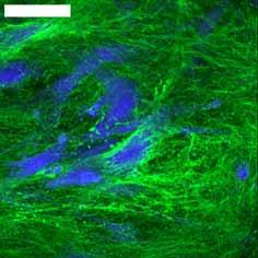 Cells and collagen fibers were randomly distributed