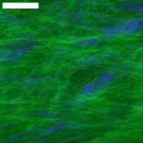 4 Spatio-temporal evolution of collagen fiber orientation The quantified collagen fiber orientations were averaged using circular statistics for all imaging depths per