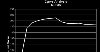 DCE MRI: Kinetic Curve Y-axis