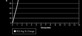 enhancement Time Intensity Curve