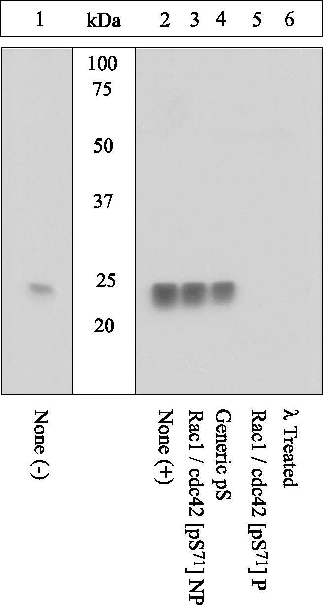 Related Products: References: Antibodies: Anti-Akt/PKB Pan, Cat. # 44-609 Akt/PKB [pt 308 ], Cat. # 44-602 Akt/PKB [ps 473 ], Cat. # 44-622 Vav1 [py 160 ], Cat. # 44-482 Vav3 [py 173 ], Cat.