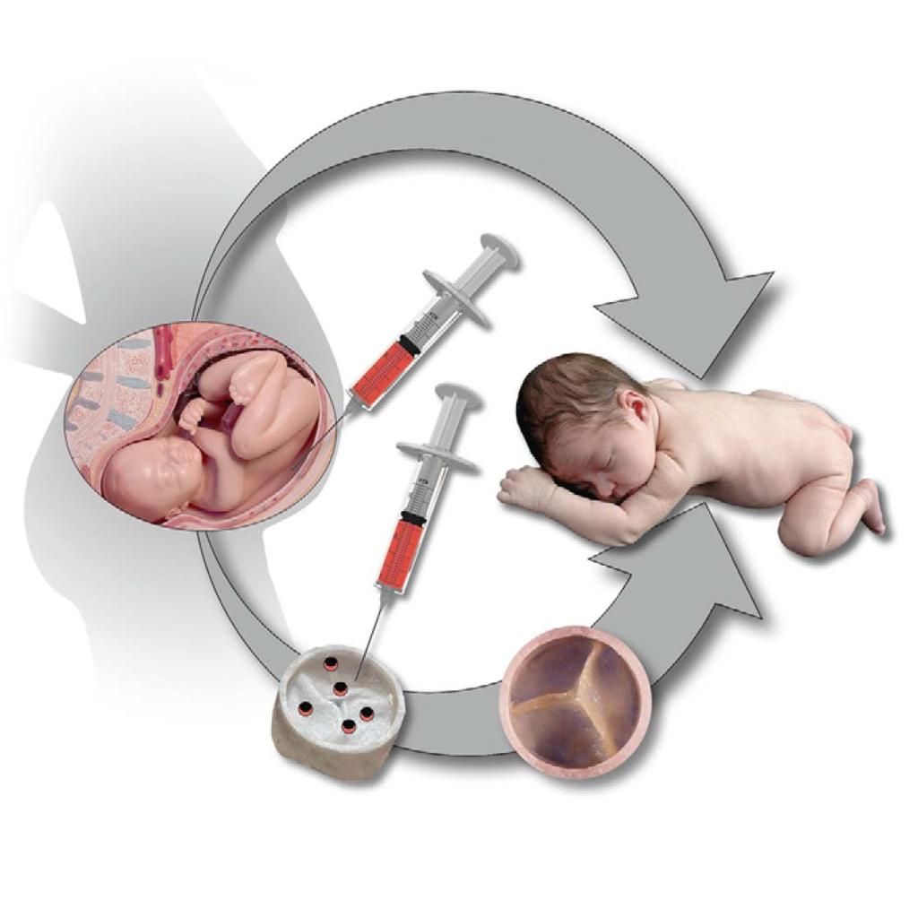 Prenatal Fetal Stem Cells amniotic fluid