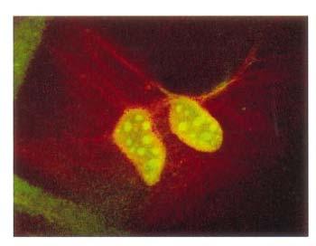 streptavidin Samples were imaged with both conventional wide-field and laser-scanning confocal fluorescence microscopes Green and red labels were clearly spectrally resolved to the