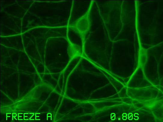 Astrocytes Neuronal Markers: Microtubule