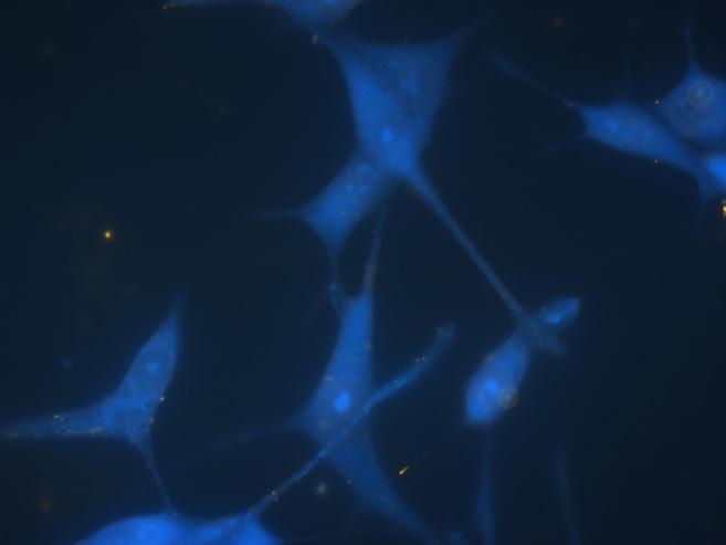 Fig. 4: Test of staining functionality of QD oligo conjugates shows no non specific staining of LnCap cells labeled with non complimentary oligonucleotides (left) and strong specific membrane