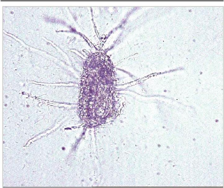 Figure 3: The oil immersion view of Pasteuria penetrans spores, (isolated from the infected female).