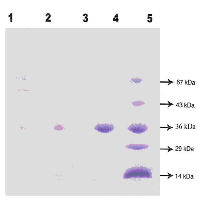 Fig. 6.3: SDS-PAGE of L-asparaginase from MNTG-7 cell line.