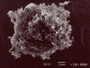 Black Carbon Aerosols An electron Microscope Image of a Black Carbon Soot particle (4). Soot being emitted from a diesel tanker (5).