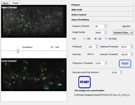 Analysis Users can analyze the reconstructed super resolution images with SPRUCE, an image analysis tool also