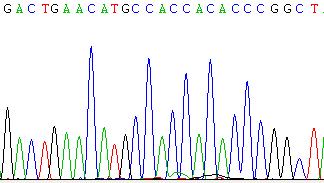 The PCR products obtained from xenografted PC3 cells that contain TMEM135 CCDC67 breakpoint before virus