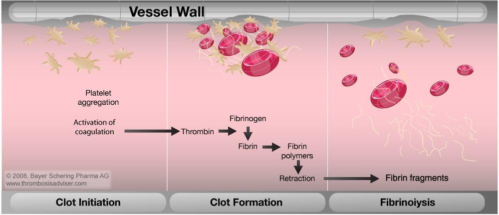 The normal physiological response that prevents significant blood loss following vascular injury is called hemostasis Blood vessel injury triggers the following sequence: The vessel constricts to