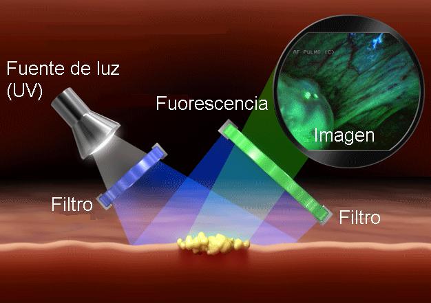 Using inherent, or endogenous, autofluorescence (AF) - Using exogenous fluorescence markers (injected drugs or creams) AF spectroscopy is