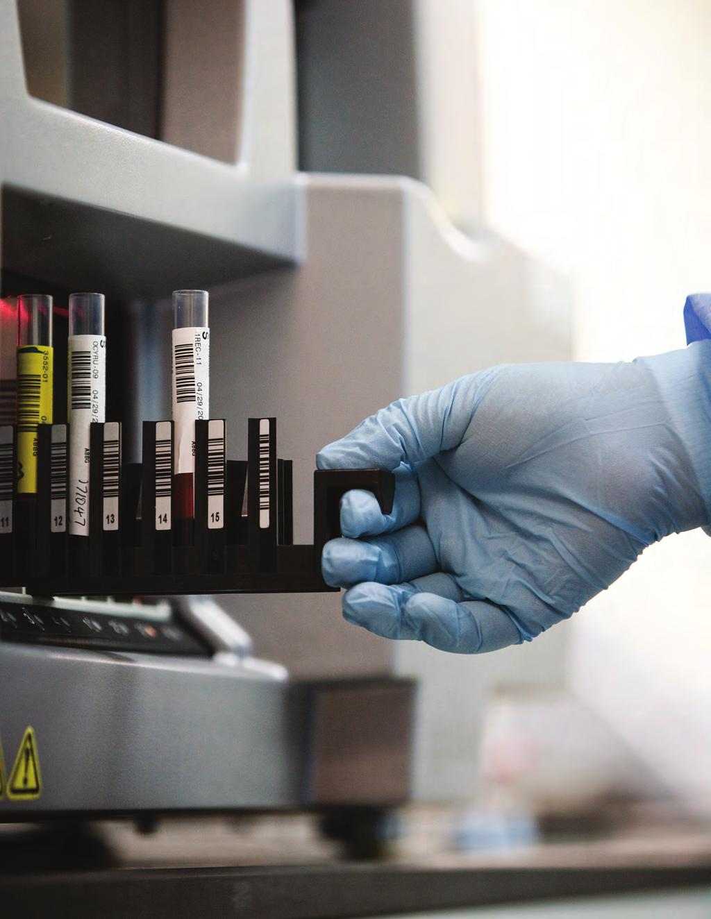 Echo delivers the ability to continuously load and unload: 20 samples, 16 reagents, 32 microstrips.