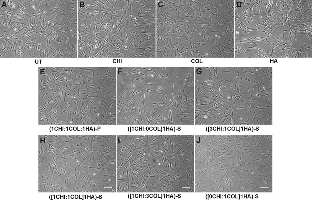 Figure 8.2 hmsc culture on selected tripolymer coated plates. Phase contrast micrographs showing hmscs on the tripolymer coated plates after 24h of seeding.