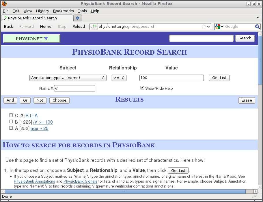 PhysioBank Record Search: Web UI Try PhysioBank Record
