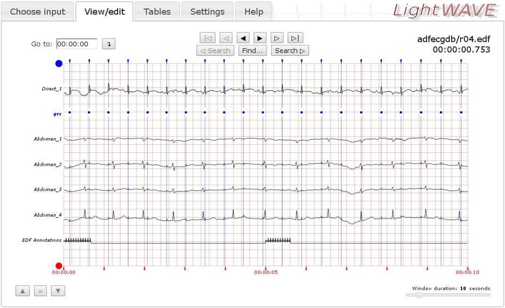 Viewing PhysioBank Data LightWAVE is a lightweight waveform and annotation viewer and editor, for viewing any of the signals and time series