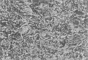 Fully quenched and tempered microstructure (SUP6, 807 K temper, 300, Nital etch.) the annealing for softening the material.