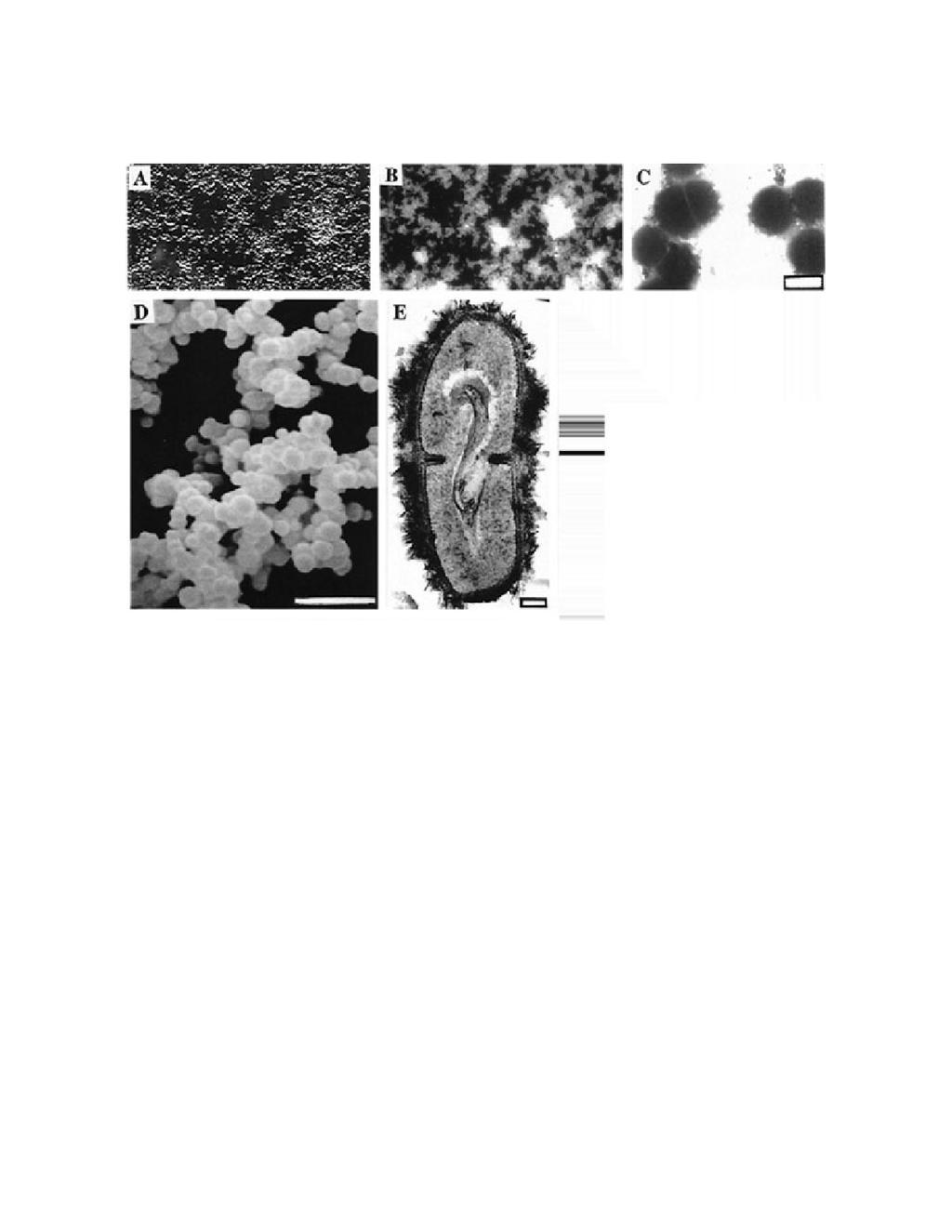 Data Sheet 1 for Part II Fig. 1. Light and electron microscopic images of nanobacteria. (A) DIC image of bottom-attached nanobacteria after a 2-month culture period.