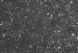 BJ fibroblasts, cultured at varying densities for reprogramming. Images were captured at Day 6 in the reprogramming protocol.