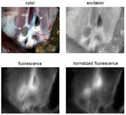 Normalization in planar fluorescence