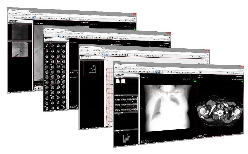 MedDream PACS MedDream PACS is a software for storing, reviewing and managing medical images, ECGs and