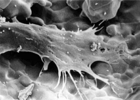Research @ Mac Figure shows that a human long bone cell growing on the surface of a hydroxyapatite foam.
