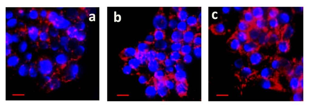 4.4.4 Biological application for tracking endosome function Fluorescent microscopy confirmed the intracellular localization of Alexa Fluor 594 in treated macrophages, suggesting internalization of