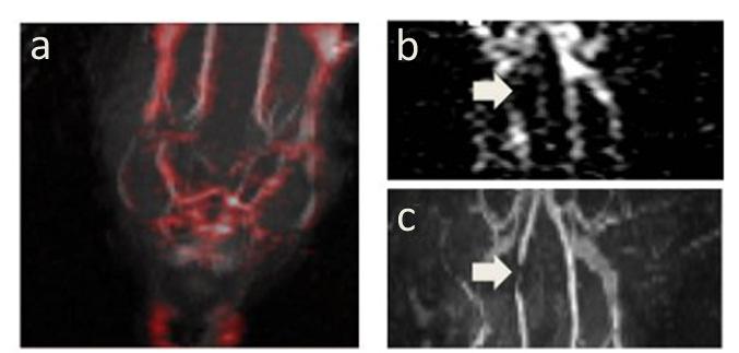 Figure 5.3 19 F angiography in mouse. (a) shows a maximal intensity projection of the 1 H and 19 F angiograms at the neck of mouse, where blood vessel geometry is clearly depicted.